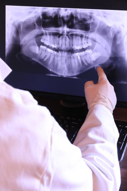 Best Emergency Dental Care for Broken or Chipped Teeth in Desnso, CA